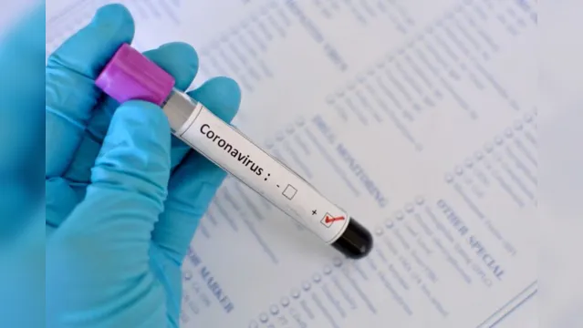 Imagem ilustrativa da notícia Por quanto tempo o coronavírus permanece no corpo dos infectados?
