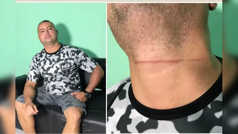 Imagem ilustrativa da notícia Cabo da PM tem pescoço cortado por linha com cerol