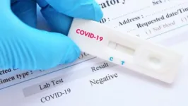 Pela primeira vez em quase quatro meses, o Brasil registrou transmissão de coronavírus sob controle.