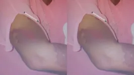 A vítima teve um dos braços machucados pelo objeto.