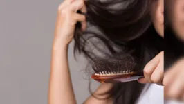 A perda de cabelo ficou à frente do peso, da má aparência e ortodontia estética.