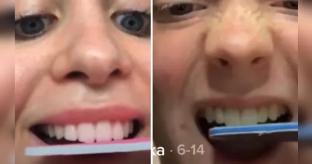 Imagem ilustrativa da notícia Viralizou: desafio do Tik Tok faz jovens serrarem os dentes