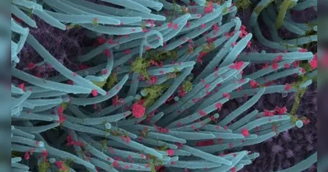 Imagem ilustrativa da notícia Imagem inédita mostra infecção por coronavírus nas vias respiratória