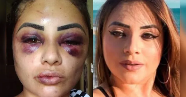 Imagem ilustrativa da notícia Blogueira é espancada, tem cabelo cortado  e olhos quase arrancados por mulheres