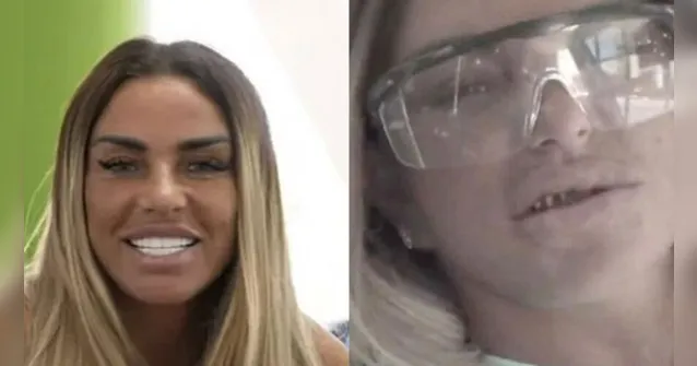 Imagem ilustrativa da notícia Modelo aparece sem próteses e choca com dentes reais