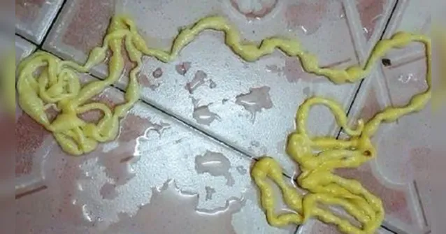 Imagem ilustrativa da notícia Taxista vai ao banheiro e retira tênia de 5 metros do ânus
