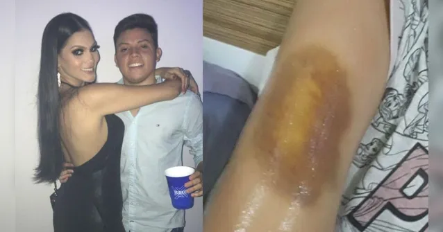 Imagem ilustrativa da notícia Paraense denuncia agressão de namorado e abusos psicológicos 