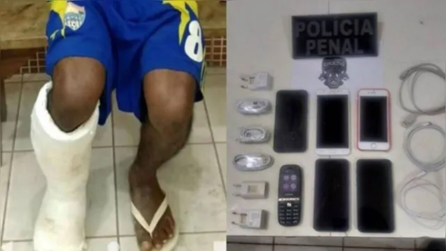 Imagem ilustrativa da notícia Jovem usa gesso na perna para esconder celulares em presídio