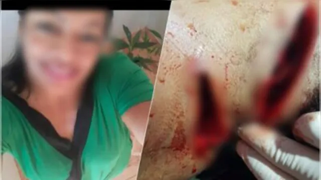 Imagem ilustrativa da notícia Mulher é atropelada e atacada a golpes de machadinha em São Miguel