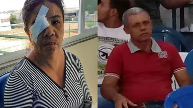 Imagem ilustrativa da notícia Pará: marido fura o olho da esposa por não gostar que ela orasse; veja o vídeo