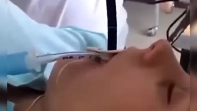 Imagem ilustrativa da notícia Médicos retiram cobra de 1,5 m da boca de uma mulher; veja o vídeo!