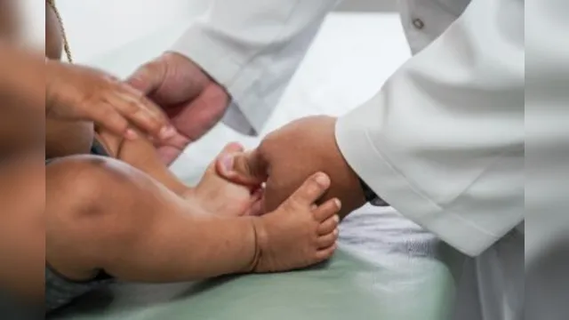 Imagem ilustrativa da notícia Estado fará cirurgias gratuitas em crianças com doenças como o pé torto congênito