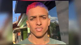 O artista fez um procedimento de harmonização facial em agosto desse ano e, desde então, tem sido alvo de ataques na internet.