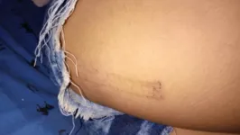 Imagem ilustrativa da notícia Adolescente é dopada e estuprada no Marajó