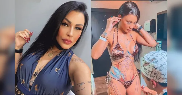 Imagem ilustrativa da notícia Filha de Gretchen faz mesma cirurgia plástica que Ludmilla