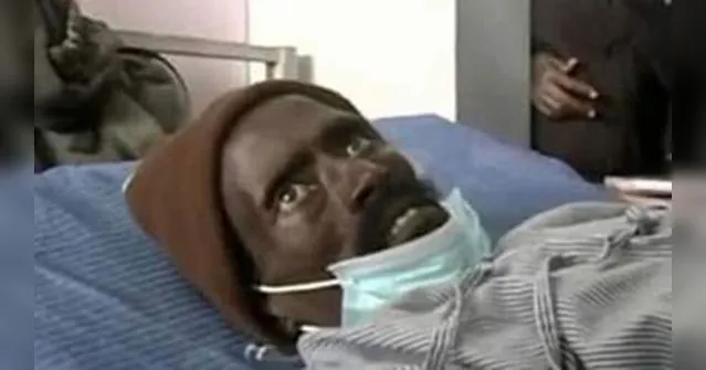 Imagem ilustrativa da notícia Homem declarado morto acorda no momento em que ia ser embalsamado