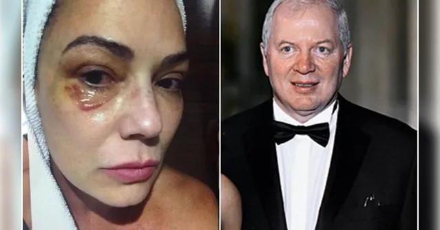 Imagem ilustrativa da notícia STF nega recurso e mantém empresário condenado por agredir Luiza Brunet