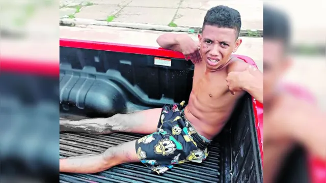 Imagem ilustrativa da notícia Suspeito é baleado e preso após cometer assaltos em Belém 