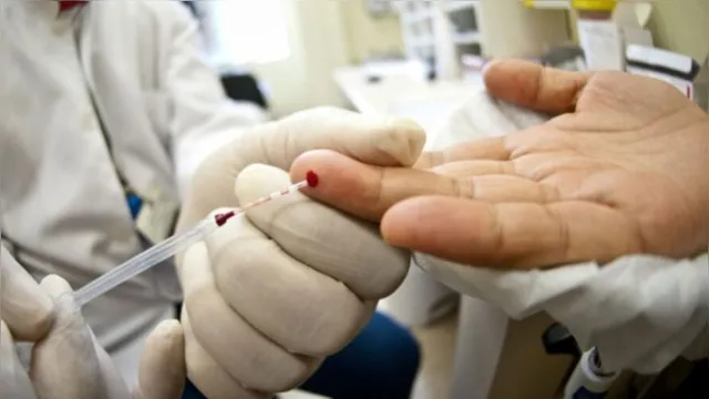 Imagem ilustrativa da notícia USP busca voluntários para testar vacina contra o HIV