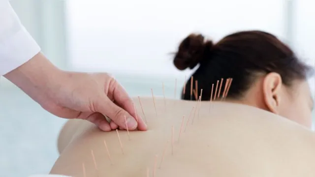 Imagem ilustrativa da notícia A eficácia da acupuntura para o tratamento da ansiedade