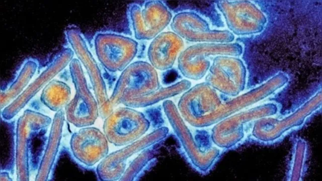 Imagem ilustrativa da notícia Vírus mortal é encontrado na Bolívia e transmissível entre humanos