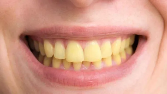 Imagem ilustrativa da notícia Veja 7 alimentos que podem manchar seus dentes e como evitar um sorriso amarelo