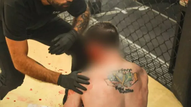 Imagem ilustrativa da notícia Imagens fortes: orelha de lutador fica rasgada em duelo com brasileiro