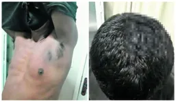 O acusado foi identificado como José Augusto Baia Leite, de 28 anos. Nas imagens, uma das pessoas feridas por ele, segundo os policiais militares