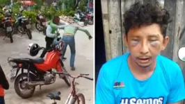 Em razão da agressão, o homem ficou com o rosto bastante machucado