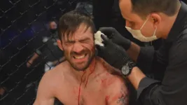 Imagem ilustrativa da notícia Imagens fortes: lutador fica com a orelha pendurada em combate