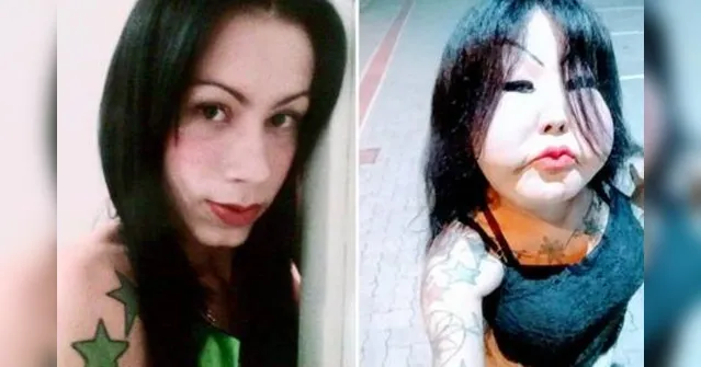 Imagem ilustrativa da notícia Trans ‘Fofão' arrecada R$8 mil em vaquinha para cirurgia