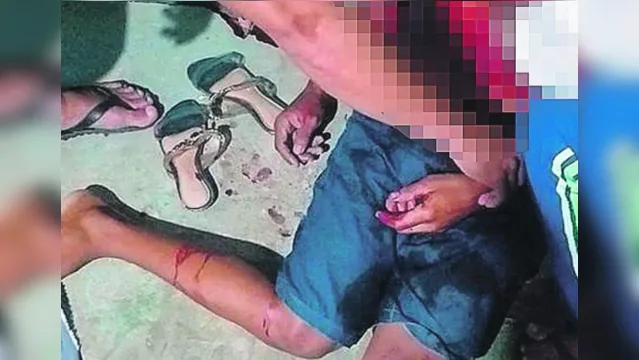 Imagem ilustrativa da notícia Homem é executado a tiros em Barcarena