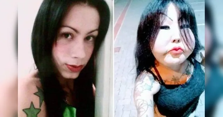 Imagem ilustrativa da notícia Trans ‘Fofão' arrecada R$8 mil em vaquinha para cirurgia