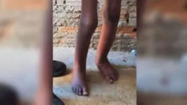 Imagem ilustrativa da notícia Polícia ouve vizinhos para descobrir por quanto tempo menino de barril foi vítima de maus-tratos