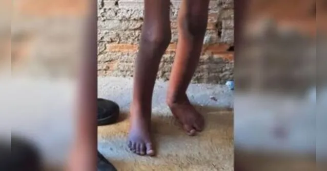 Imagem ilustrativa da notícia Polícia ouve vizinhos para descobrir por quanto tempo menino de barril foi vítima de maus-tratos