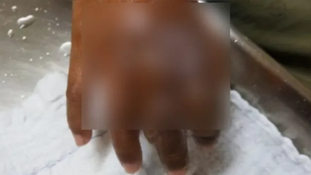 Imagem ilustrativa da notícia Mãe é presa após jogar água fervendo na mão do próprio filho em Tailândia