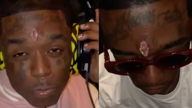 Imagem ilustrativa da notícia Após implantar diamante na testa, rapper diz temer pela vida