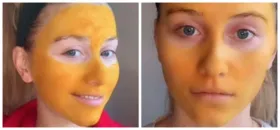 Imagem ilustrativa da notícia Máscara caseira dá errado e mulher fica com o rosto tingido de amarelo, veja!