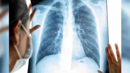 Estudo de pesquisadores da USP mostra que SARS-CoV-2 inibe remoção de células mortas e favorece dano pulmonar.