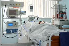 Imagem ilustrativa da notícia Hospitais particulares do Pará podem ficar sem kit intubação