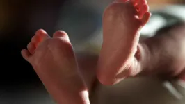 Imagem ilustrativa da notícia Bebê nasce com três pênis e é o primeiro caso no mundo