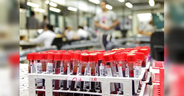 Imagem ilustrativa da notícia Coleta de sangue ocorre neste domingo para atender demanda