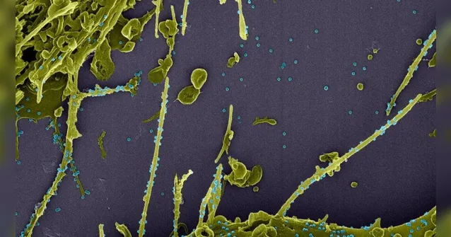 Imagem ilustrativa da notícia Nova variante do coronavírus que escapa ao teste PCR já está sendo investigada