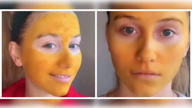 Imagem ilustrativa da notícia Máscara caseira dá errado e mulher fica com o rosto tingido de amarelo, veja!