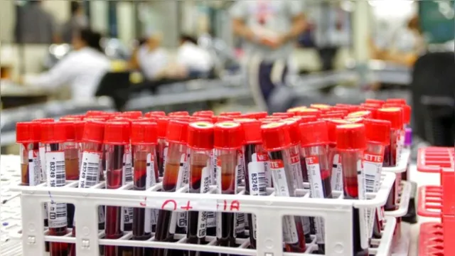 Imagem ilustrativa da notícia Hemopa amplia atendimento para coleta de sangue no Pará; veja onde doar!
