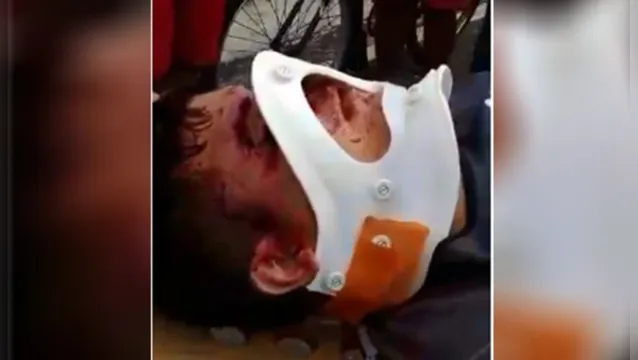 Imagem ilustrativa da notícia Vídeo: socorrista coloca colar cervical invertido em vítima de acidente no Pará