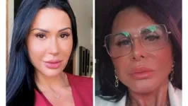 Gretchen (à direita) foi comparada à musa fitness Gracyanne Barbosa (à esquerda) após procedimento