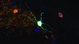 Grupo cria vírus capaz de atuar em áreas específicas de cérebros adultos, ajudando a elucidar o papel de neurônios-chave no córtex pré-frontal