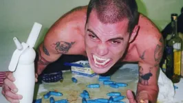 Steve-O chegou a ser hospitalizado logo no início das gravações