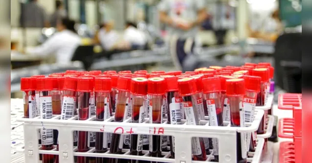 Imagem ilustrativa da notícia Hemopa reabre posto de coleta de sangue em Belém